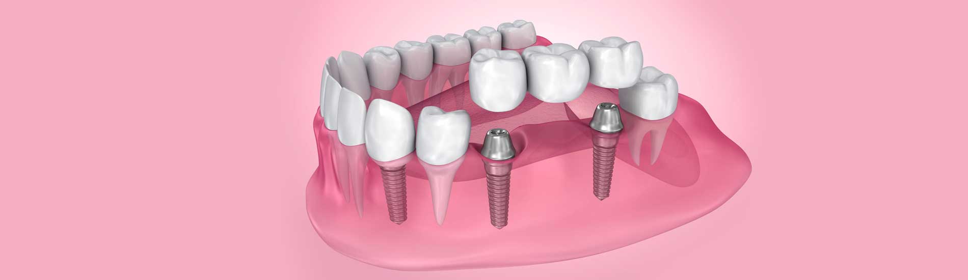 Monarch Dentistry