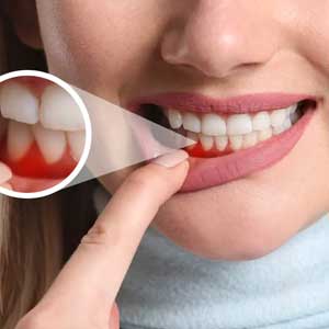 Periodontics