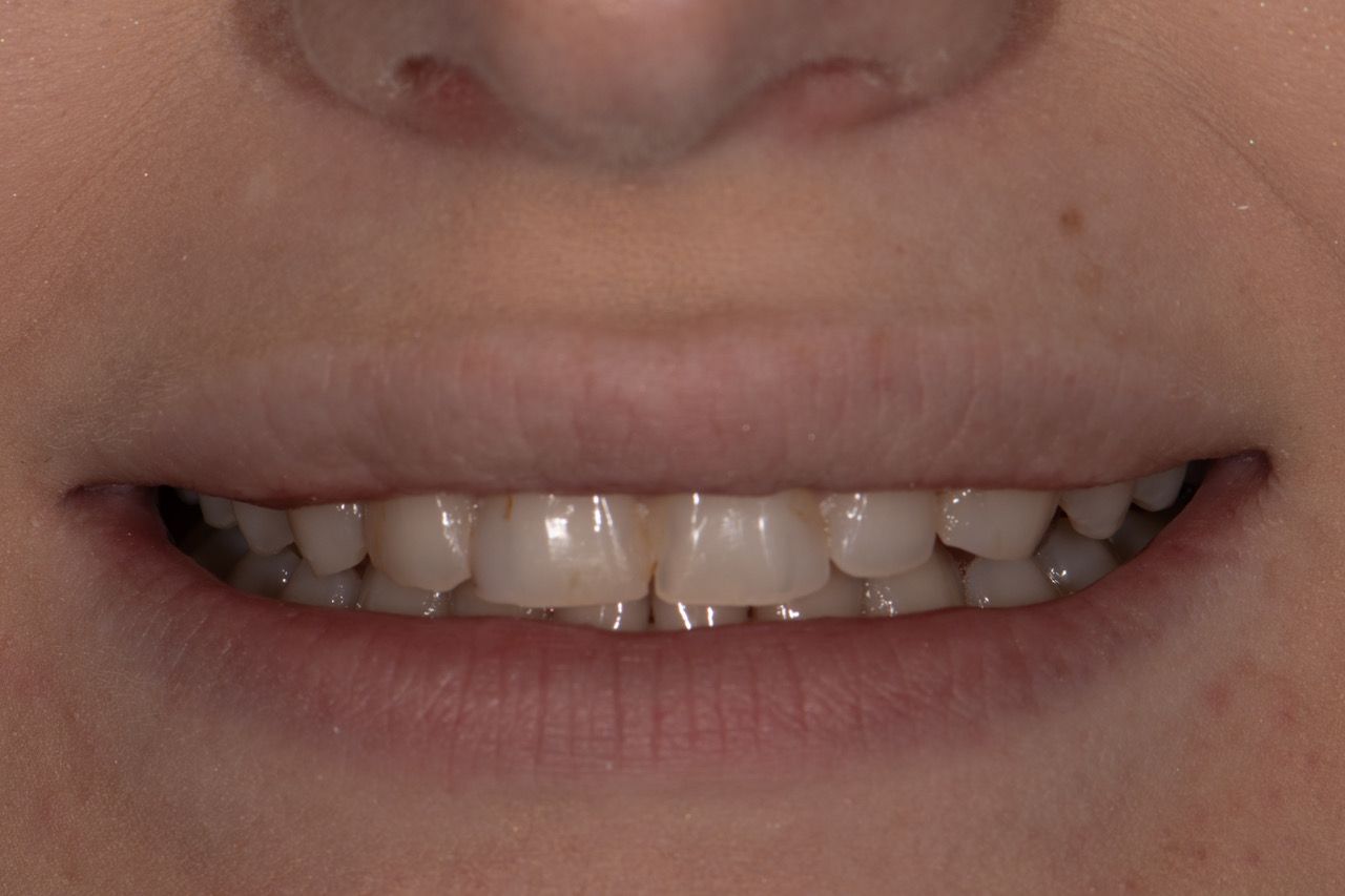 Monarch Dentistry