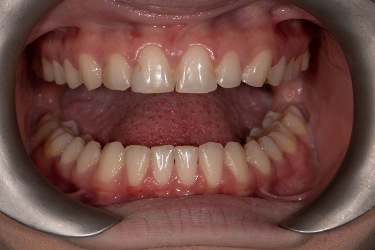 Monarch Dentistry