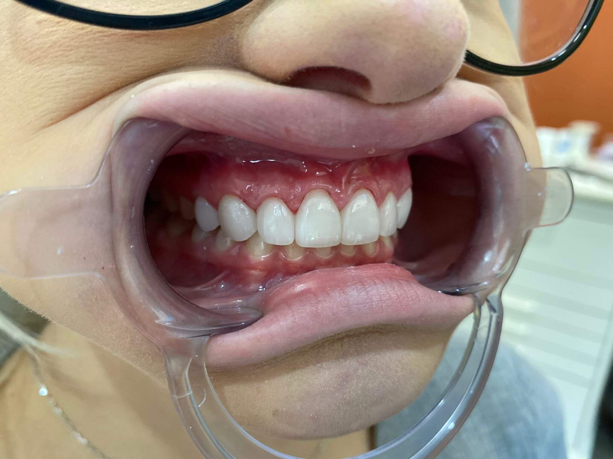 Monarch Dentistry