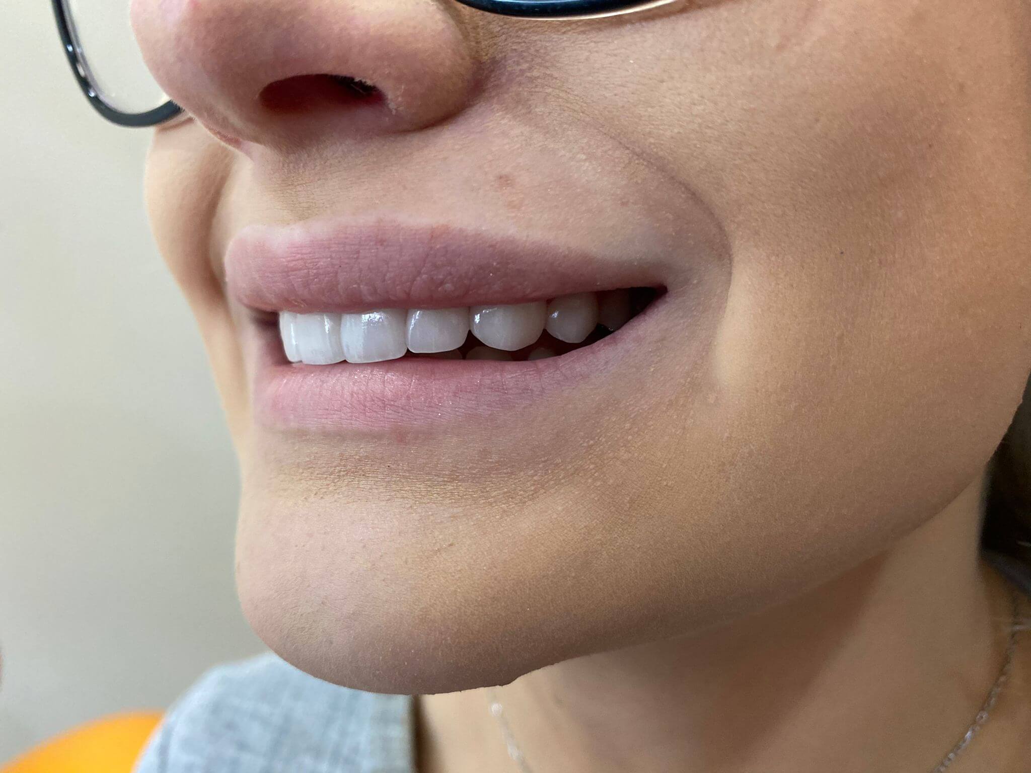 Monarch Dentistry