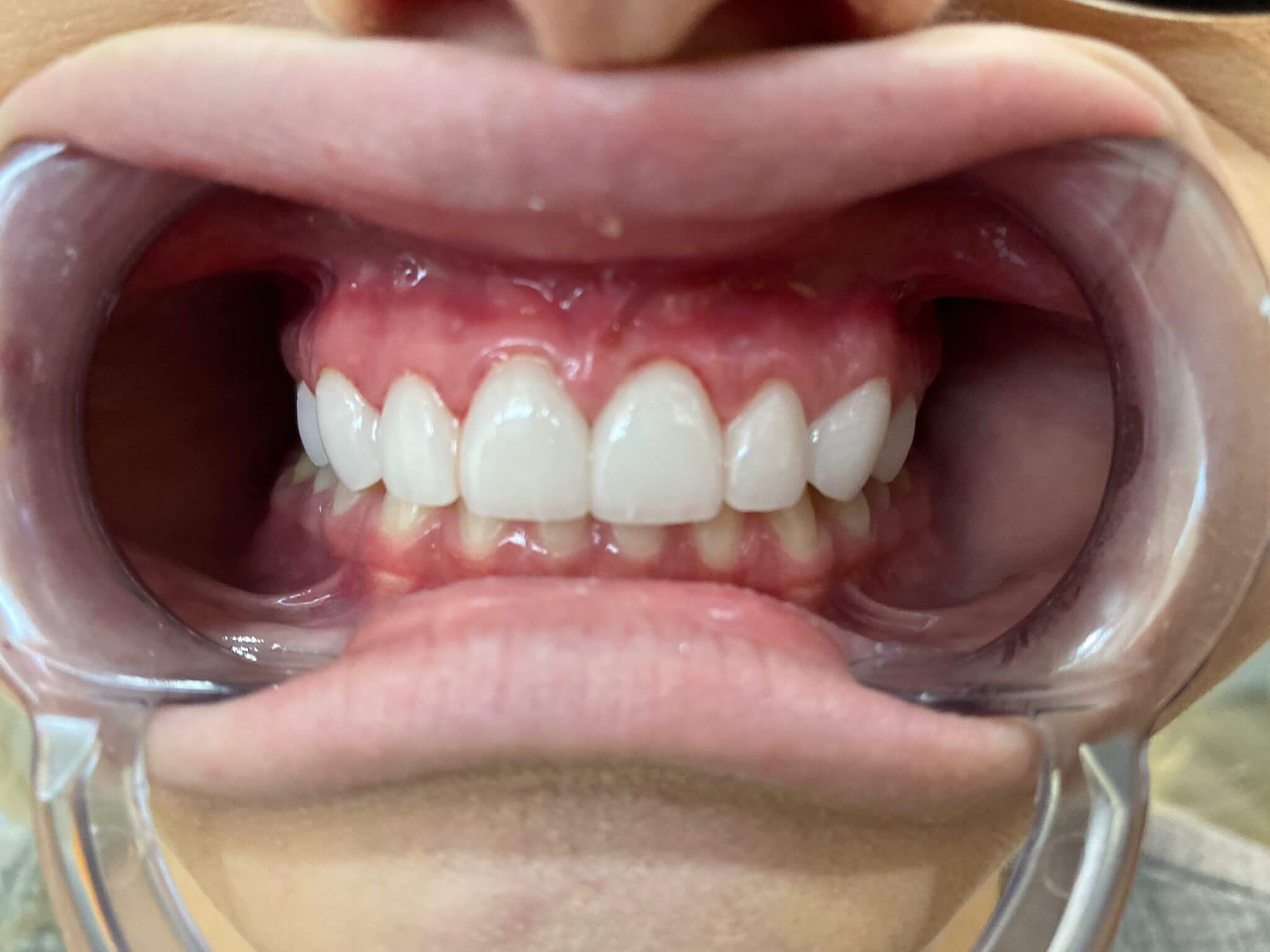 Monarch Dentistry