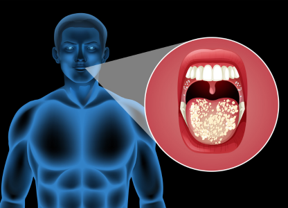 Understanding the Importance of Oral Cancer Screenings