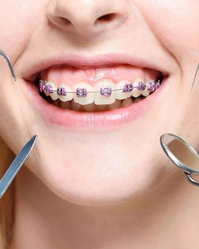 Family Orthodontics
