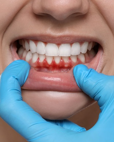 Periodontics