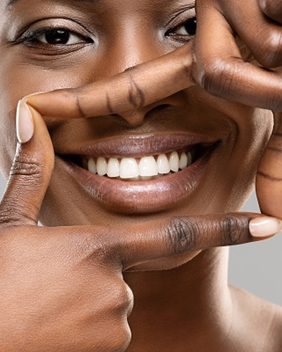 Teeth Whitening