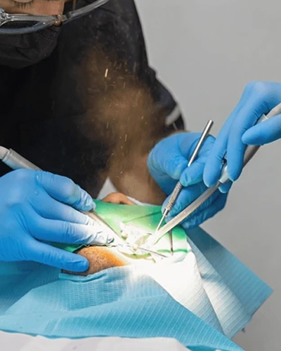 Amalgam Free Fillings