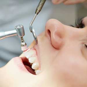 Dental Cleaning