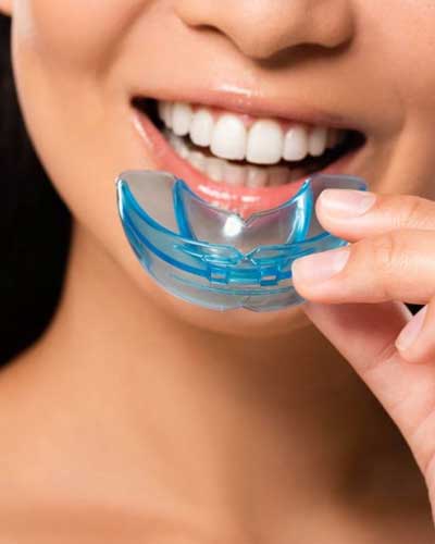 Night & Athletic Mouth Guards