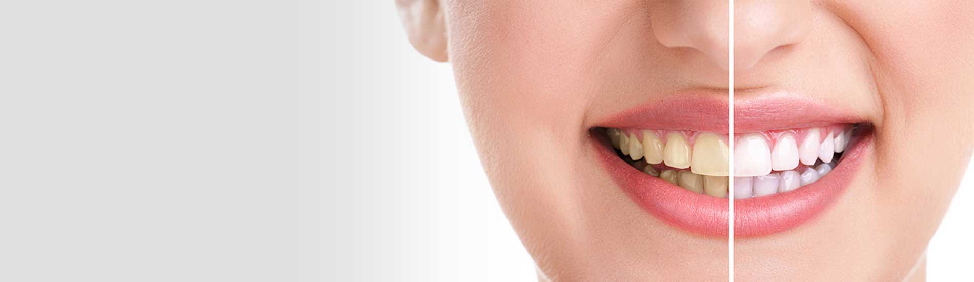 Monarch Dentistry