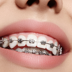 Family Orthodontics