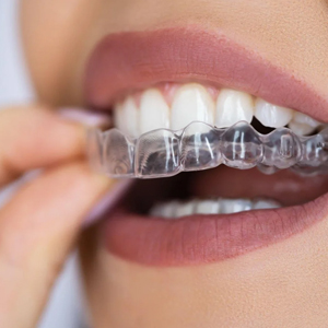 Invisalign