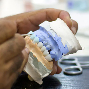 Full Mouth Construction