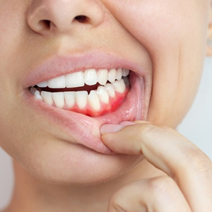 Periodontics