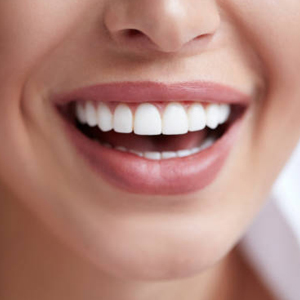 Cosmetic Bonding