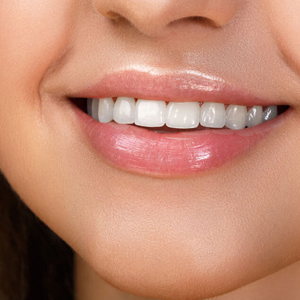 Full Mouth Reconstruction